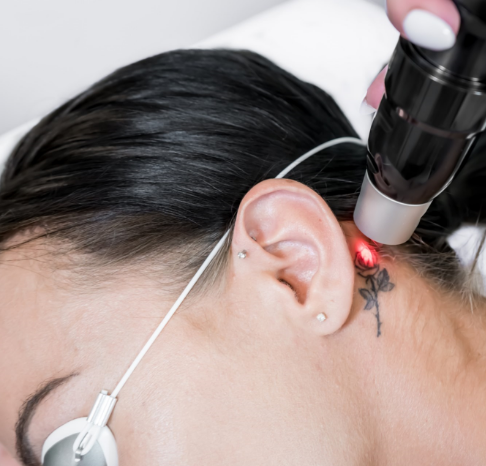 Can Diabetics Get Tattoos and Piercings What to Know Before You Go   Everyday Health